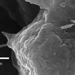 Carbon nanotubes penetrating lung cell (c) Robert R. Mercer, Ann F. Hubbs, James F. Scabilloni, Liying Wang, Lori A. Battelli, Diane Schwegler-Berry, Vincent Castranova and Dale W. Porter / NIOS, CC0